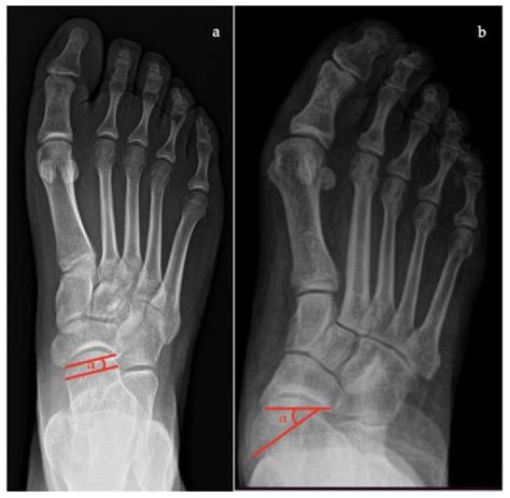 Discover Lexie Thompson's Height: Uncovering The Stats