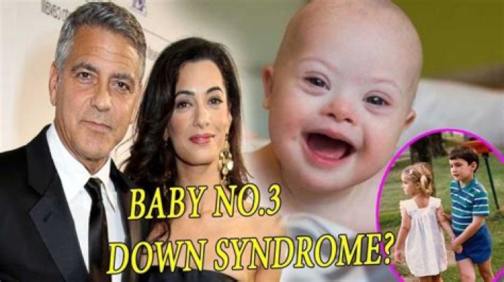 Does George Clooney's Son Have Down Syndrome? Facts Revealed