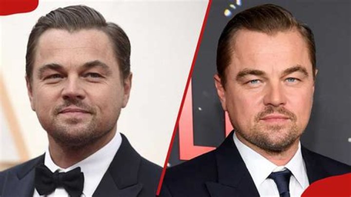 Prominent Actors With Cleft Lip And Palate